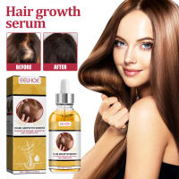 El líquido de crecimiento nutre, reafirma, solidifica el cabello, mejora la reparación, fortalece las raíces y previene la caída del cabello. - details 1