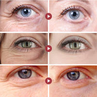 Crema para los Ojos con Retinol Anti-envejecimiento, Firmante, Iluminadora y Hidratante - details 1