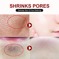 Crema Reductora de Poros de Ácido Salicílico Eliminación Rápida de Pimientas Piel Suave y Lisa - details 14