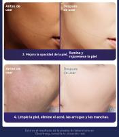 radiofrecuencia facial Página de inicio EMS micro corriente para apretar la piel de rejuvenecimiento fotónico instrumento inteligente de masaje facial y belleza masajeador Cepillo facial eléctrico - details 4