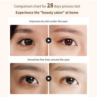 Masajeador EMS de ojos y cara, terapia de luz roja, antiarrugas, estiramiento, Reduce las ojeras, cuidado de la piel, varita de belleza ocular de 360 ° - details 6