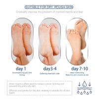 Urea Hidratante Pies, nutre y suaviza, mejora la sequedad, hidrata, cuidado de los pies - details 3