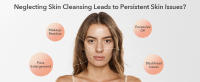 neglecting skin cleansing leads to some persistent skin issue