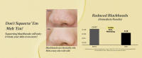 Pure cleansing oil_Blackheads improvement_PC