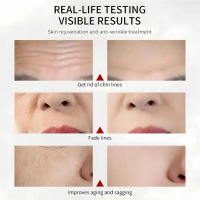 Caviar crema Facial antiarrugas eliminación suero Facial rejuvenecimiento elevación firme antienvejecimiento blanqueamiento Invisible belleza de poros cuidado de la piel - details 0