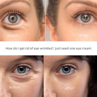Crema Antideslumbramiento para Ojos Serum Antiedad para Eliminar Ojeras, Cirros, Hinchazón - details 3