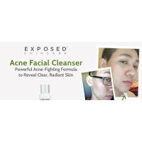 Limpiador facial para el acné Exposed Care, cara suave con tendencia al acné con ácido salicílico, limpiador clarificador de poros para adolescentes y adultos, todos - details 0