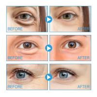 Crema para Ojos de Cafe Ilumina Arrugas, Reduce Líneas Finas, Reafirma y Brilla en el Área del Ojo - details 1
