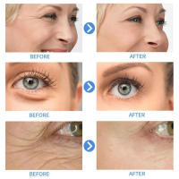 Crema Instantánea para Eliminar Arrugas Reafirmante Antiedad Blanqueador Hidratante Iluminador Ajustador de Piel Herramienta de Cuidado de la Piel Facial - details 1