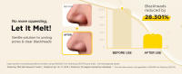 4_Clinical results