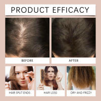 Repara las puntas secas y encrespadas, mientras que el aceite esencial de romero nutre e hidrata el cuidado del cabello. - details 8
