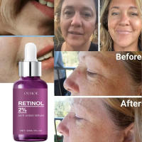 Sérum de Rejuvenecimiento con Retinol Reducción de Arrugas, Enderezamiento, Iluminación - details 2