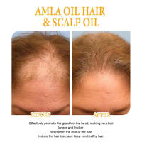 La biotina nutre la raíz, repara el cabello seco y encrespado, previene el cabello con spray para cabello denso y fijo. - details 7