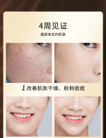 Nuevo Instrumento de Belleza Ultrasónico Reafirmante y Levantador de Microcorriente EMS Facial - details 6