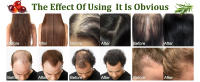 Batana oil for hair growth