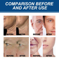 Reduce las líneas finas, reafirma la piel, protege e hidrata el rostro, aplique crema facial lifting. - details 8