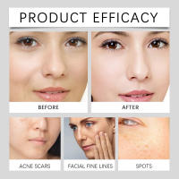 Potente crema de suero blanqueador para eliminar manchas, vitamina C, esencia para iluminar la piel, eliminación de Melasma, manchas oscuras, hidrata, belleza, cuidado de la piel - details 1