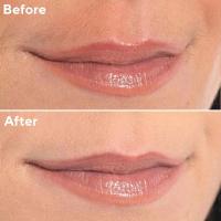 Afeitadora Facial y Recortadora de Cejas 2 en 1 Portátil, Recargable, para Labios - details 14