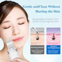 Espátula ultrasónica para el cuidado de la piel, masajeador Facial, eliminación de espinillas y piel muerta, exfoliación Facial electrónica - details 5