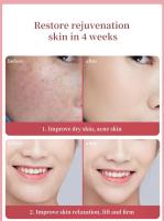 Artículos de belleza Microcorriente Calor frío Hogar Radiofrecuencia facial Instrumento de belleza Levantamiento y estiramiento - details 5