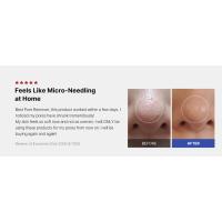 microneedle, Zero exosome shot, Lacto exosome, instant pore-tightening care, Pore Refining serum