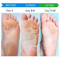 Crema de manos antiarrugas de colágeno, suaviza la piel, nutre la reparación agrietada, blanqueamiento, producto hidratante antisecado, cuidado de la piel coreano - details 2