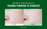 essence b&a