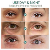 Crema eliminadora de ojeras, suero antienvejecimiento de Retinol, elimina las bolsas de los ojos, hinchazón, desvanece las arrugas, líneas finas, levanta el cuidado de los ojos firme - details 5