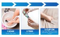 Dispositivo de tratamiento láser de hongos para uñas, reparación de hongos en las uñas de los pies, tratamiento de onicomicosis, relajación de hongos - details 1