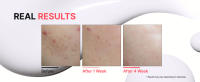 Korean Skincare, Spot Cream, Dull Skin, Acne-Prone Skin