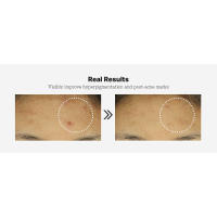 real results acne hyperpigmentation good for skin texture hydrate firm dry dull fine lines wrinkles