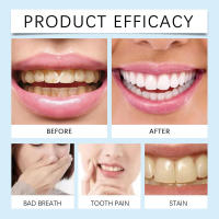 Limpieza de caca, limpieza bucal, blanqueamiento, confianza, sonrisa y cuidado dental. - details 6