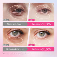 Crema de colágeno para ojos, elimina las bolsas de los ojos, antiojeras, hinchazón, Reduce las arrugas, humectante reafirmante, belleza, producto para el cuidado de la piel - details 4