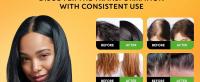 batana oil for hair growth