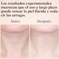 reducir las arrugas