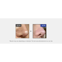 microneedle, Zero exosome shot, Lacto exosome, instant pore-tightening care, Pore Refining serum