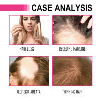 El aceite esencial para hidratar, repara las puntas secas y encrespadas, previene la electricidad estática, suaviza el cuidado y solidifica el cabello. - details 5