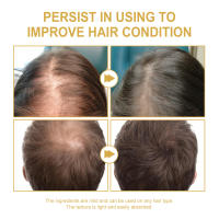Romero para el cuidado de la limpieza del cuero cabelludo, reparación suave y esponjosa, fijación de furia seca y aceite esencial reafirmante para el cabello - details 7