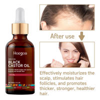 El crecimiento hidrata, repara, fortalece, previene la caída, reafirma y solidifica el aceite esencial para el cuidado del cabello. - details 4