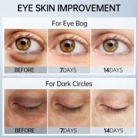 Crema para los Ojos de Colágeno Reducción de Arrugas, Levantamiento, Desvanecimiento de Líneas Finas, Hidratación, Iluminación Anti-Inchazo - details 5