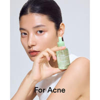 For Acne