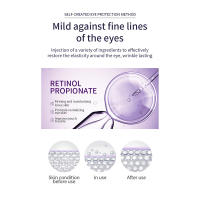 Rodillo masajeador de crema para ojos antiarrugas, antiojeras, bolsas hidratantes para ojos, ácido hialurónico antienvejecimiento, productos para el cuidado de la piel de los ojos - details 2