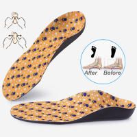 Plantillas ortopédicas profesionales para niños, almohadillas para pies planos, Cubitus, Varus XO, plantillas para zapatos - details 27