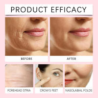 Retinol Hidratante, Nutritivo, Iluminador de la Piel Facial, Esencia Delicada e Hidratante - details 8