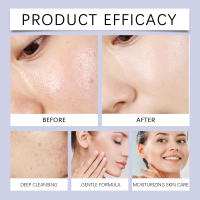 Gentle Soothing Cleanser es un limpiador hidratante que limpia la piel con una textura refrescante y no apretada. - details 11