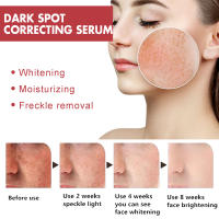 Sérum de Eliminación de Manchas Dark Corrector de Melanina Hidratante y Iluminador - details 5