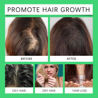 El cuidado del aceite esencial de Rosemary Batana nutre el cabello seco y cuida el cabello hidratado e hidratado. - details 7