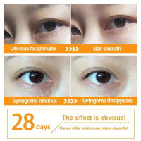 Suero de Ojos Firmador Anti-Hinchazón Reductor de Granos de Grasa Desvanece Ojeras - details 7