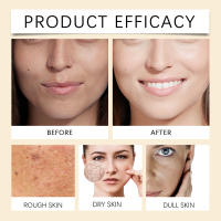 Agua de arroz hidratante suave hidratante diaria loción facial nutritiva profunda - details 11