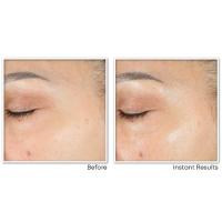 Unretouched Before & After 4 Weeks of Use